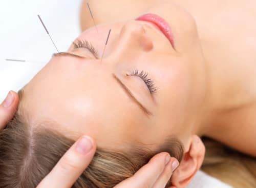 AGOPUNTURA AGOPUNTURA